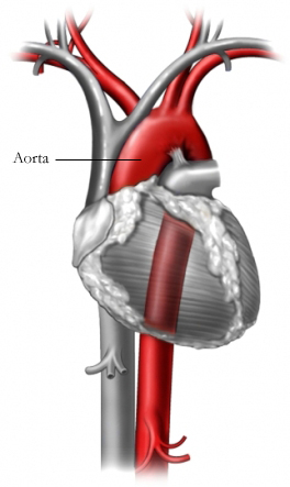 Aorta - SignWiki