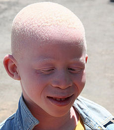 Albino