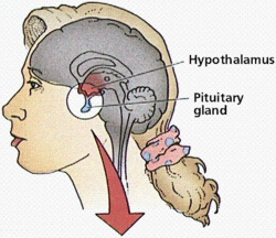 Pituitary glad